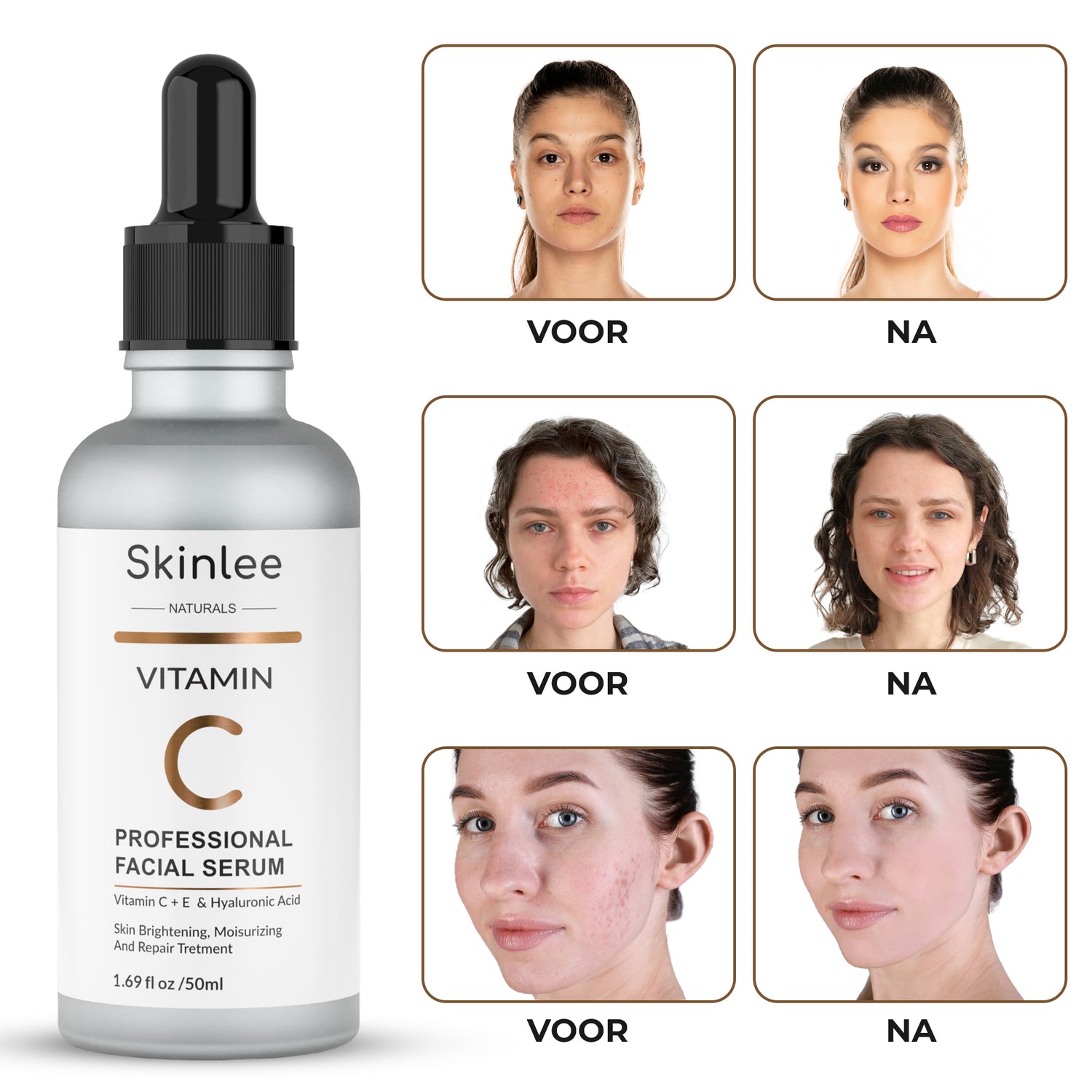 Vitamine C Serum